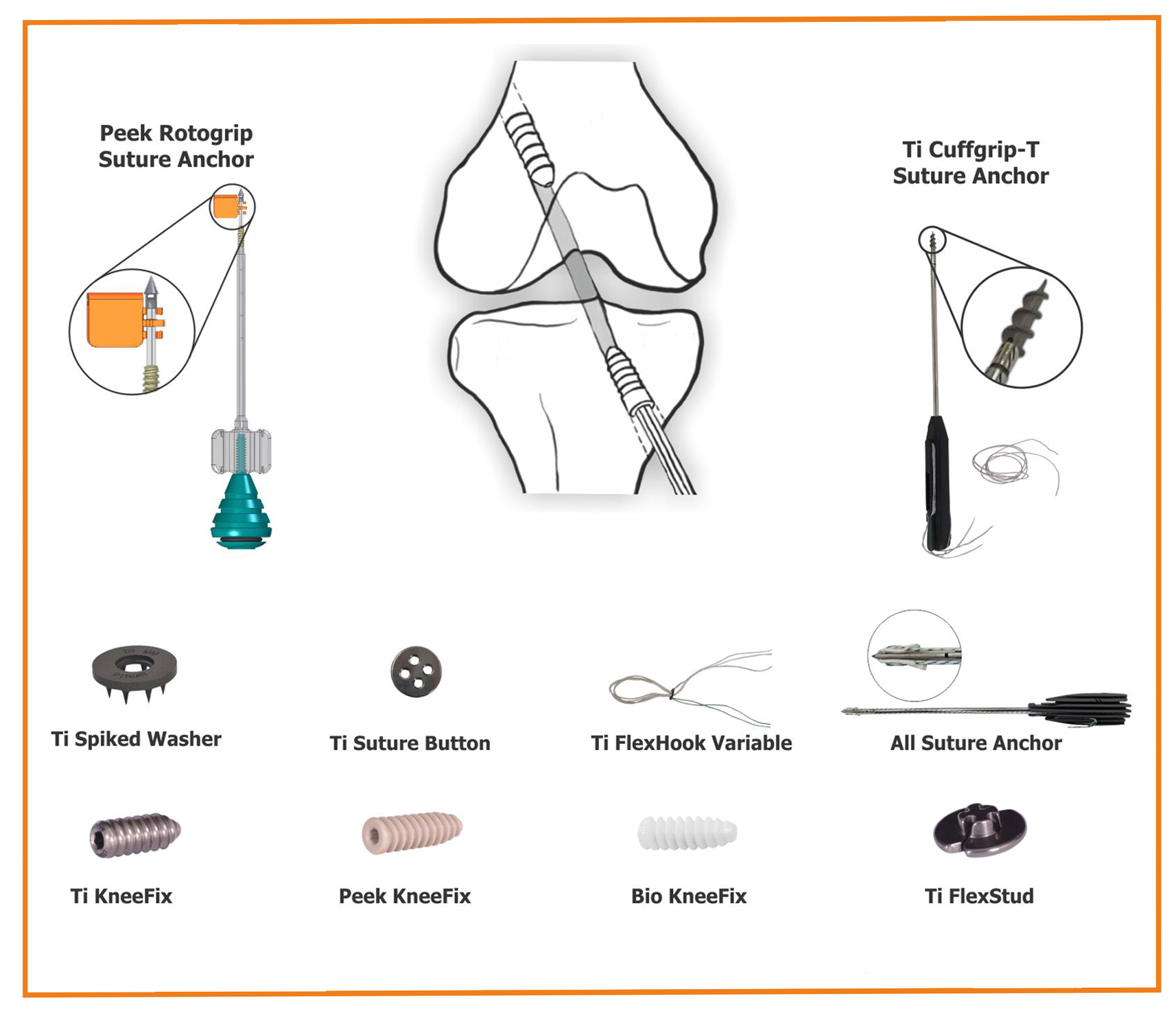 Arthroscopy System